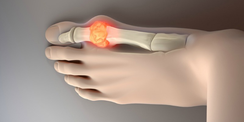 ízületi és derékfájás melyik orvoshoz kell fordulni az artrózis kezelésére
